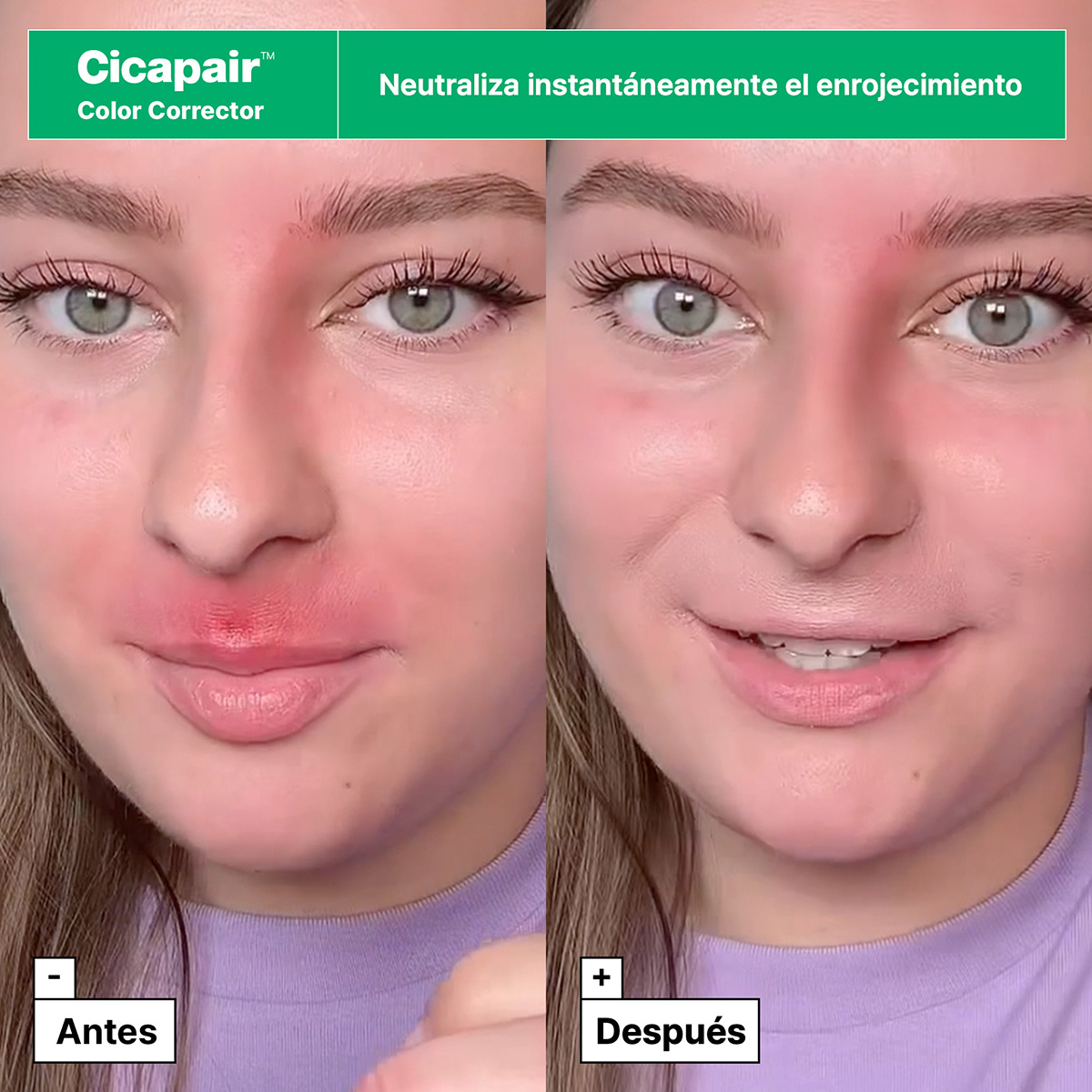 CICAPAIR™ REDNESS REDUCERS GIFT SET FOR SENSITIVE SKIN (SET PARA CUIDADO DE LA PIEL)